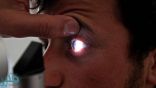 “اصفرار العين”.. مؤشر بسيط على أمراض خطيرة