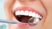 خبراء يحذرون من خطورة تبييض الأسنان أثناء الحمل