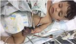 الطفل جسار حالته ساءت بشكل غريب وتحولت يده للون الأسود (صورة )