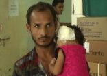 بالصور.. انتزاع 80 دودة من أذن طفلة في الهند