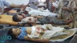 مجزرة حوثية شرقي تعز تقتل وتصيب 13 طفلاً يمنياً