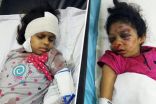 الجيران سمعوا الصراخ.. عاملة إثيوبية تعتدي بالضرب على طفلتين وأمهما بطريقة وحشية في جازان