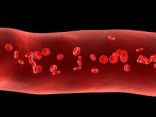 دراسة: الصيام المتقطّع يوقف تطور سرطان الدم
