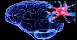 علماء ينجحون في زراعة خلايا عصبية في المخ
