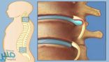 مجموعة نصائح مهمة لمرضى الانزلاق الغضروفي