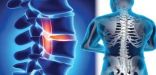 دراسة : آلام الظهر مؤشر خطر ويجب مراجعة الطبيب بشكل فوري