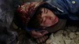 شاهد : مقتل امرأتين وطفل وإصابة العشرات بينهم 4 أطفال و15 من الدفاع المدني في مجازر روسية بريف إدلب