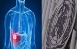 منظمة الصحة العالمية : التهاب الكبد أكبر مسببات الوفاة في العالم