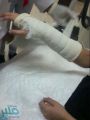 معلمة بالطائف تعتدي على طالبة ثانوية وتكسر يدها