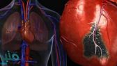 النمر: 3 أنواع من الخلافات تزيد احتمالية الإصابة بجلطة القلب
