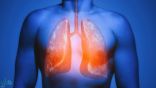 دراسة حديثة: اكتشاف سحري لإصلاح خلايا الرئة المسرطَنة من التدخين