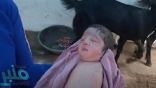 شاهد.. ولادة طفلة في الهند بدون أطراف