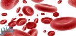 أضرار فقر الدم على الصحة وأسبابه المختلفة
