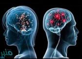 دماغ الرجل أم المرأة… دراسة تكشف “الفارق المذهل”