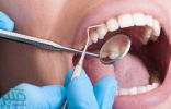اضرار و فوائد تنظيف الجير من الأسنان