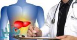 تعرف على.. التهاب الكبد الوبائي A أسبابه وأعراضه