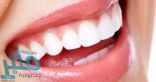 ماهى الشروط لنجاح عملية زراعة الأسنان؟