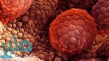 دراسة: العلاج الإشعاعي لسرطان البروستاتا يزيد خطر إصابة المثانة‎