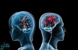 دراسة: مخ المرأة يظل يعمل ولا يخلد للراحة مثل مخ الرجل