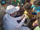 مركز الملك سلمان للإغاثة يواصل مشروع دعم التغذية للأطفال والأمهات باليمن