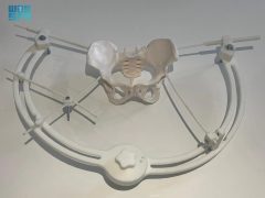 استشاري جراحة العظام في وزارة الداخلية يحصل على براءة اختراع لجهاز إنقاذ إصابات الحوض في الحوادث الشديدة