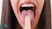5 علاجات طبيعية لحروق اللسان